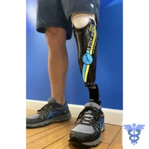 SM. V V S BELOW KNEE