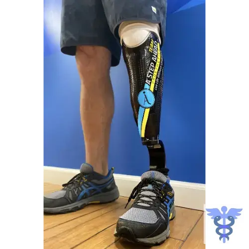 SM. V V S BELOW KNEE